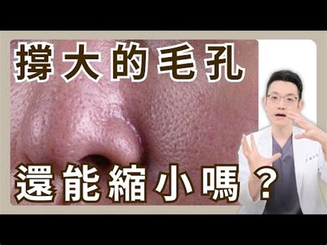 臉上長白毛拔掉|臉長白毛：避免誤診與誤治